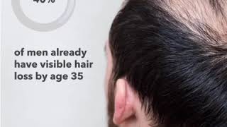 AnteAGE MD Hair Restoration [upl. by Eelidnarb]