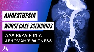 Elective AAA repair in a Jehovahs Witness  anaesthesia Exam Case anesthesiology exam [upl. by Koblas]