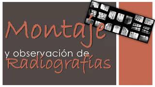 MONTAJE Y OBSERVACIÓN DE RADIOGRAFÍAS DENTALES [upl. by Nnyla]