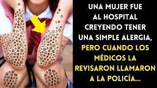 Mujer Fue Al Hospital Creyendo Tener Una Simple Alergia Médicos Al Revisarla Llamaron A La Policía [upl. by Chaunce]