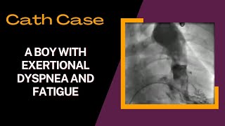 Cath Case Pulmonary Stenosis PS on ventriculography cardiology cath diagnosis [upl. by Berna]