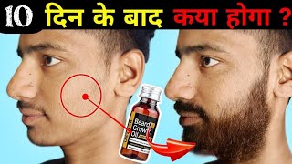 Ustraa Advanced Beard Growth Oil After 10 Days Review Best Beard Oil For Patchy Beard in India 2024 [upl. by Siroled]