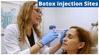 Botox Frontalis Glabella amp Nefertiti Treatment  Botox Injection Sites [upl. by Fidele911]