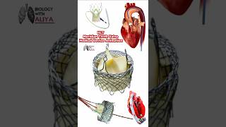 HLT Meridian TAVR Valve Medical Device Animation medical animation 3d short BiologywithAliya [upl. by Rojam102]