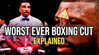 WORST EVER BOXING CUT EXPLAINED TONY WEEKS [upl. by Niamor]