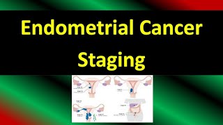 Endometrial Cancer Staging FIGO Guideline 2023 Updates [upl. by Sherwin653]