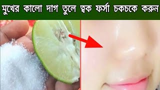 ২ মিনিটে মুখের কালো দাগ দূর করার উপায়লেবু চিনির সাথে মাত্র ১টি উপকরণ মিশিয়ে ত্বক ধবধবে ফর্সা করুন [upl. by Shepley129]