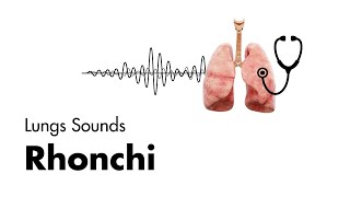 Rhonchi  Lung Sounds  Medzcool [upl. by Clovah]