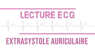 Interprétation ECG  Extrasystole Auriculaire quotESAquot [upl. by Leiruh523]