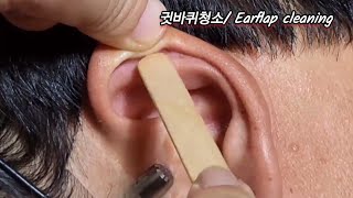 ASMR Real Series 귓바퀴청소 Earflap cleaning 耳介清掃 [upl. by Notgnirrac]