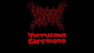 Paracoccidioidomicosisproctitissarcomucosis  Viscera infest [upl. by Aeslehs947]