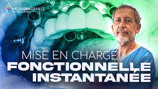 Mise en charge fonctionnelle instantanée [upl. by Gert254]