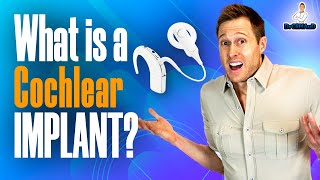 What is a Cochlear Implant [upl. by Illib10]