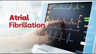 What is Atrial Fibrillation [upl. by Alyk498]