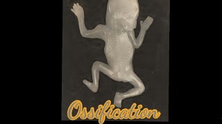 Ossification  Meaning  Pronunciation  Usage [upl. by Castorina427]