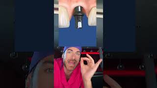 Voici 3 solutions pour remplacer une dent manquante shorts [upl. by Hampton242]