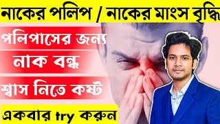 নাকের পলিপাস নাকের পলিপ নাকের পলিপাস দূর করার উপায়  Nasal polyps Homeopathic Medicine [upl. by Young940]