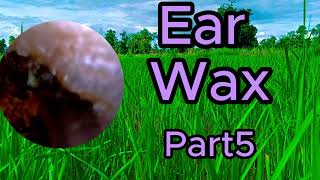 ear wax removal asmr [upl. by Ocsecnarf]