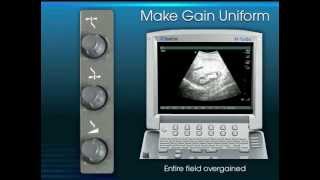 Clinical UltrasoundPhysics and Knobology [upl. by Dalpe]