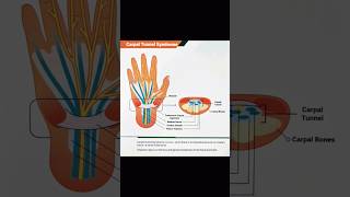 Part2 cts numbness neurologist neuro hospital doctor health kothagudem [upl. by Rancell566]