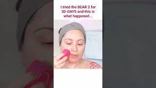 FOREO BEAR 2⚡30DAY CHALLENGE RESULTS 😮foreo bear2 30daychallenge [upl. by Dlanigger707]