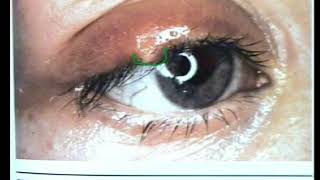 Floridas 20Hour Contact Lens Board Certification Webinar [upl. by Forsta591]