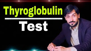 Thyroglobulin Test [upl. by Eniretak]