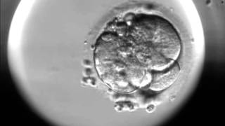 Timelapse of fertilisation of a human egg under the microscope [upl. by Conn192]