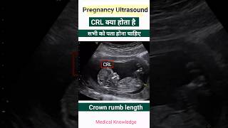 Pregnancy report में CRL क्या होता है  Pregnancy ultrasound report देखना सीखे pregnancy [upl. by Fitzsimmons]