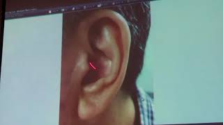 Ear Diagnosis by Jimmy Chang Part 1 [upl. by Barbabas]