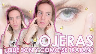 ¿CÓMO SE TRATAN LAS OJERAS Aprende a diagnosticar y tratar tu tipo de ojeras [upl. by Paluas]