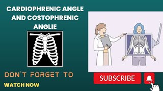 costophrenic and cardiophrenic angle and lungs zone [upl. by Ttennej]