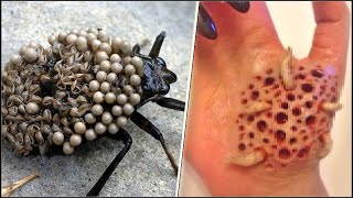 20 Insectos Más Aterradores Y Peligrosos Del Mundo [upl. by Adiuqal]