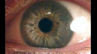 Eye Works 1 Focusing Cornea Iris and Lens [upl. by Charlet]