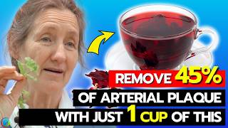 Clear CLOGGED ARTERIES Instantly  Barbara Oneill Reveals The 1 SOLUTION To Change Your Life [upl. by Amandy]