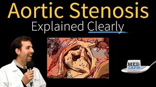 Aortic Stenosis Explained Clearly  Diagnosis and Treatment [upl. by Pell]