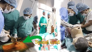 College first vlog spinal techniqueSurgury Spinal cordPrinceRajBR07  review2024 [upl. by Atwood656]