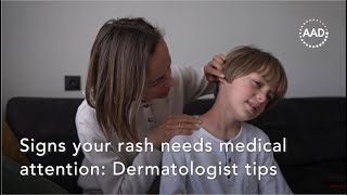 Signs your rash needs medical attention Dermatologist tips [upl. by Kyrstin]