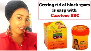 Carotone black spot Corrector review Fade off black spots quickly [upl. by Lacefield]