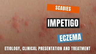 Scabies Impetigo and Eczema  Causes Pathophysiology Clinical Presentation and Treatment [upl. by Odragde512]