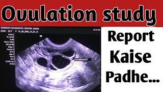 Follicular monitoringke Report kaise padheअंडे की जांच [upl. by Oirtemed53]