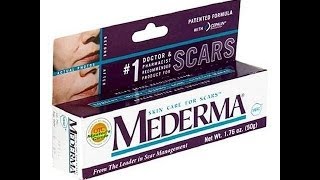 Mederma cream review  mederma cream  mederma advanced scar gel review [upl. by Dun482]