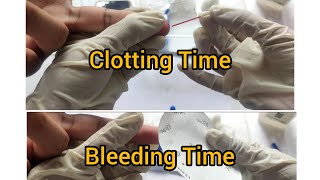 bt ct blood test bt ct Bleeding Time amp Clotting Time Test  Capillary tube method [upl. by Ahearn]