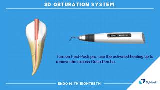 How to Use Eighteeth Obturation System FastPack FastFill Continuous Wave Compaction WVC [upl. by Mirisola101]