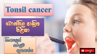 Tonsil cancer ටොන්සිල ආශ්‍රිත පිලිකා how it happens causes symptoms treatment sinhala prevent [upl. by Chaddie]