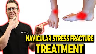 Navicular Stress Fracture Treatment Exercise Shoes amp Stretches [upl. by Otineb]