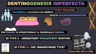 Dentinogenesis Imperfecta [upl. by Novak917]