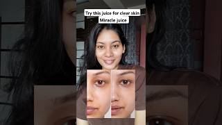 Miracle juice for clear skin skincare skincaretips viralshorts viralvideo [upl. by Ewen601]