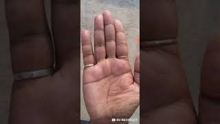 Fish sign Good Palm But no Money for Faithline absent palmistry Hindi analysis of real palm [upl. by Mcdougall]