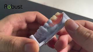 What is the best flexible denture [upl. by Oine]